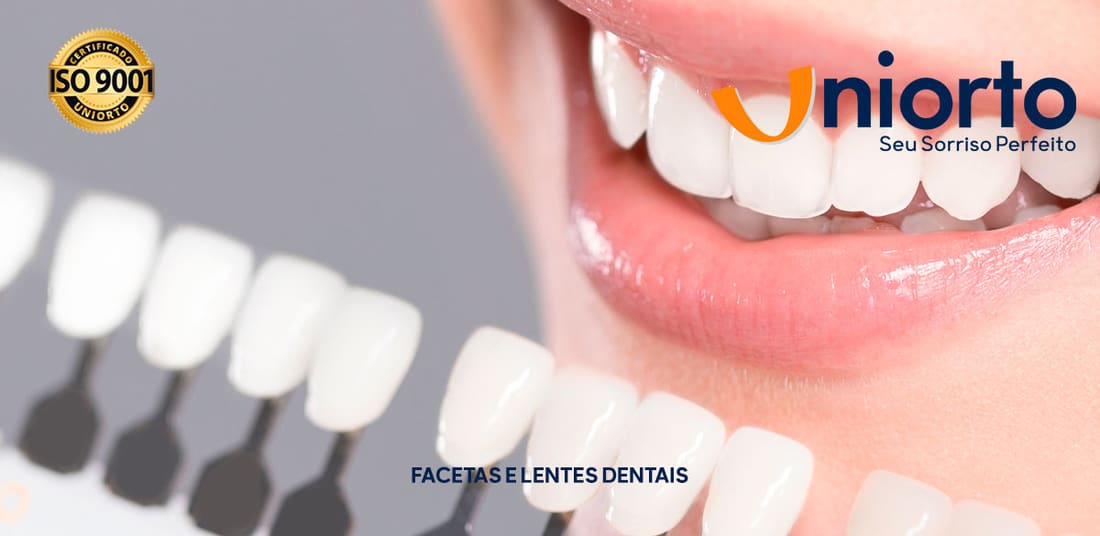 Facetas e Lentes Dentais — foto do tratamento na Uniorto