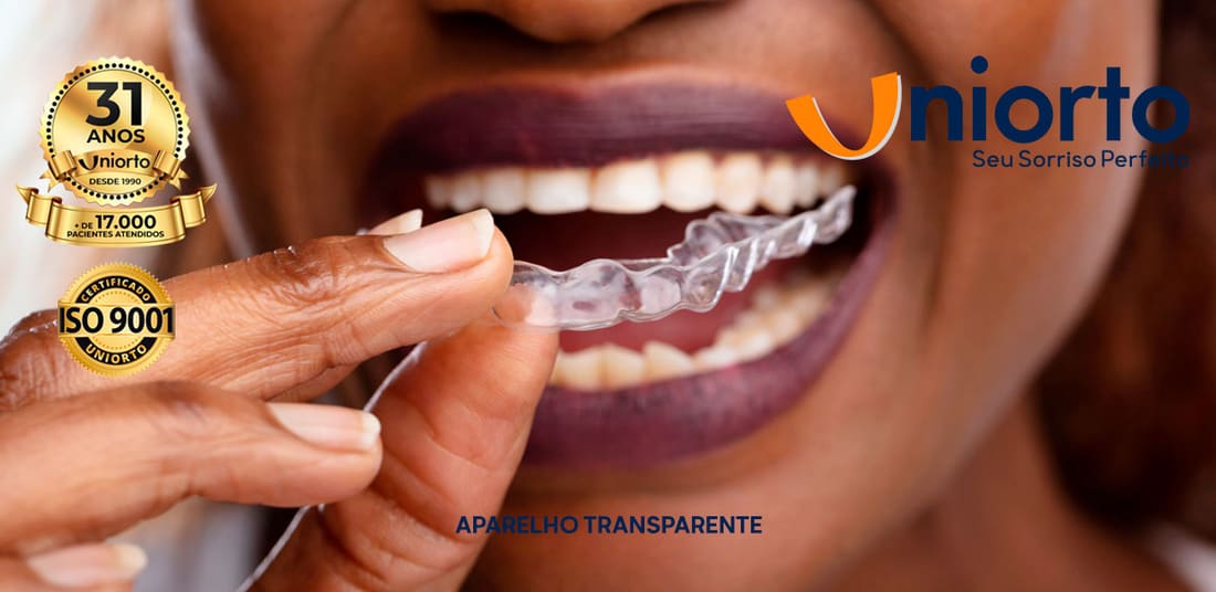 Aparelho Transparente — foto do tratamento na Uniorto